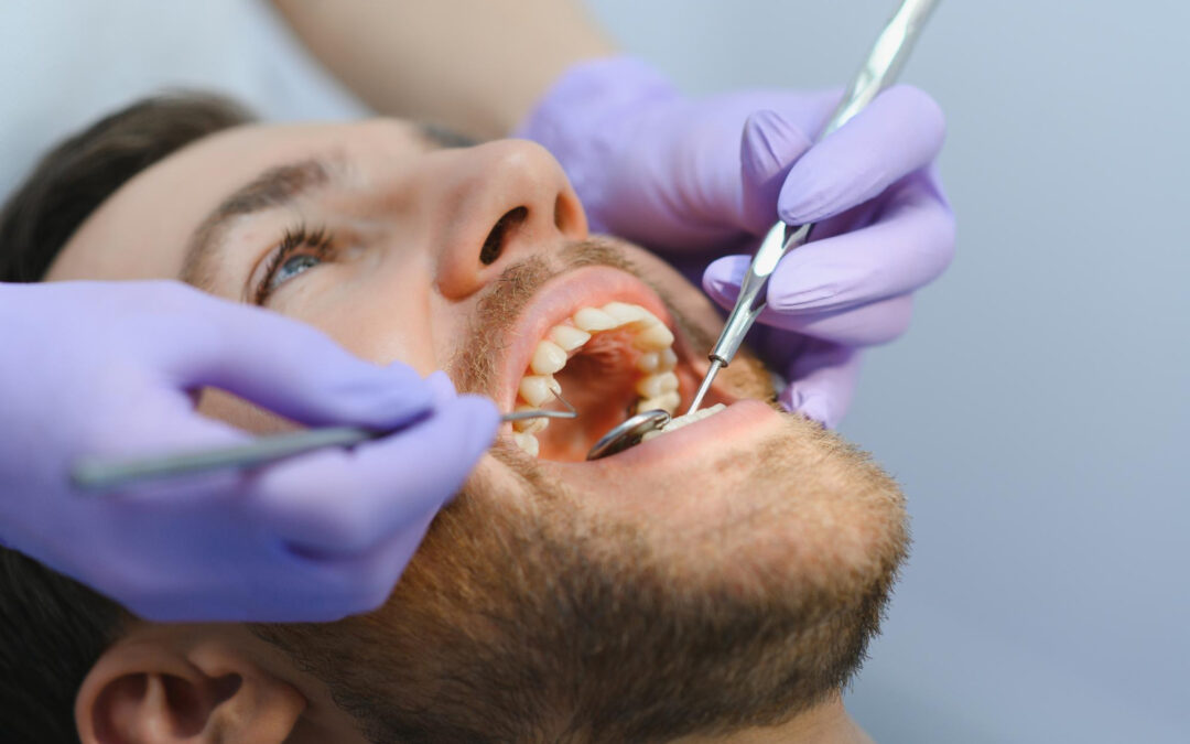 4 cose che devi sapere sui tuoi denti