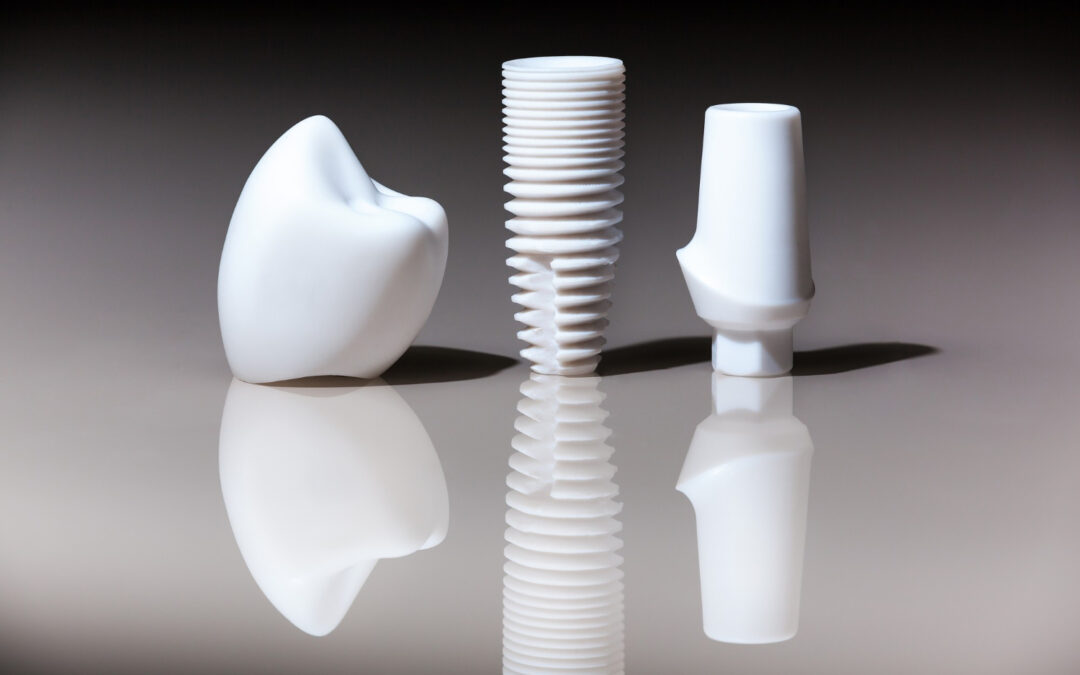 La grande svolta per l’implantologia: Impianti Dentali Bianchi
