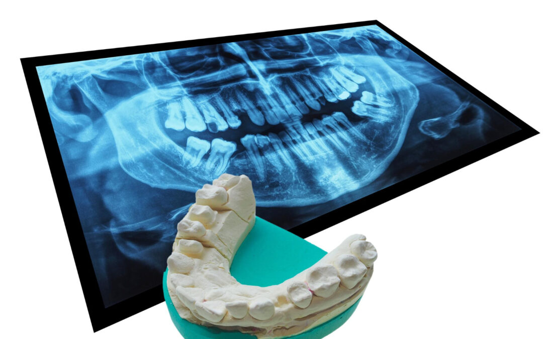 Tac Dentale 3D
