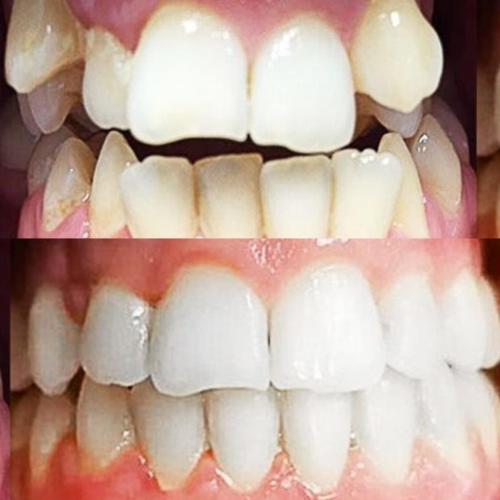 ortodonzia smiledoc
